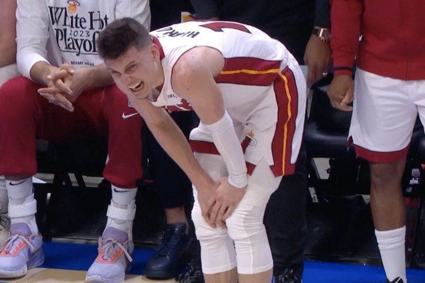 Tyler Herro right hand