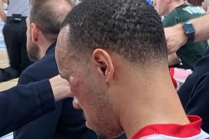 Olimpia Milano, brutto colpo al volto per Shabazz Napier