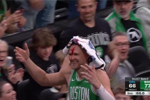 Kristaps Porzingis shrugs off blood and pain: I love my WWE moments