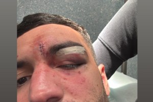 La rissa, la squalifica di Borra e i punti di Landi: tutto quello che è successo a Roseto